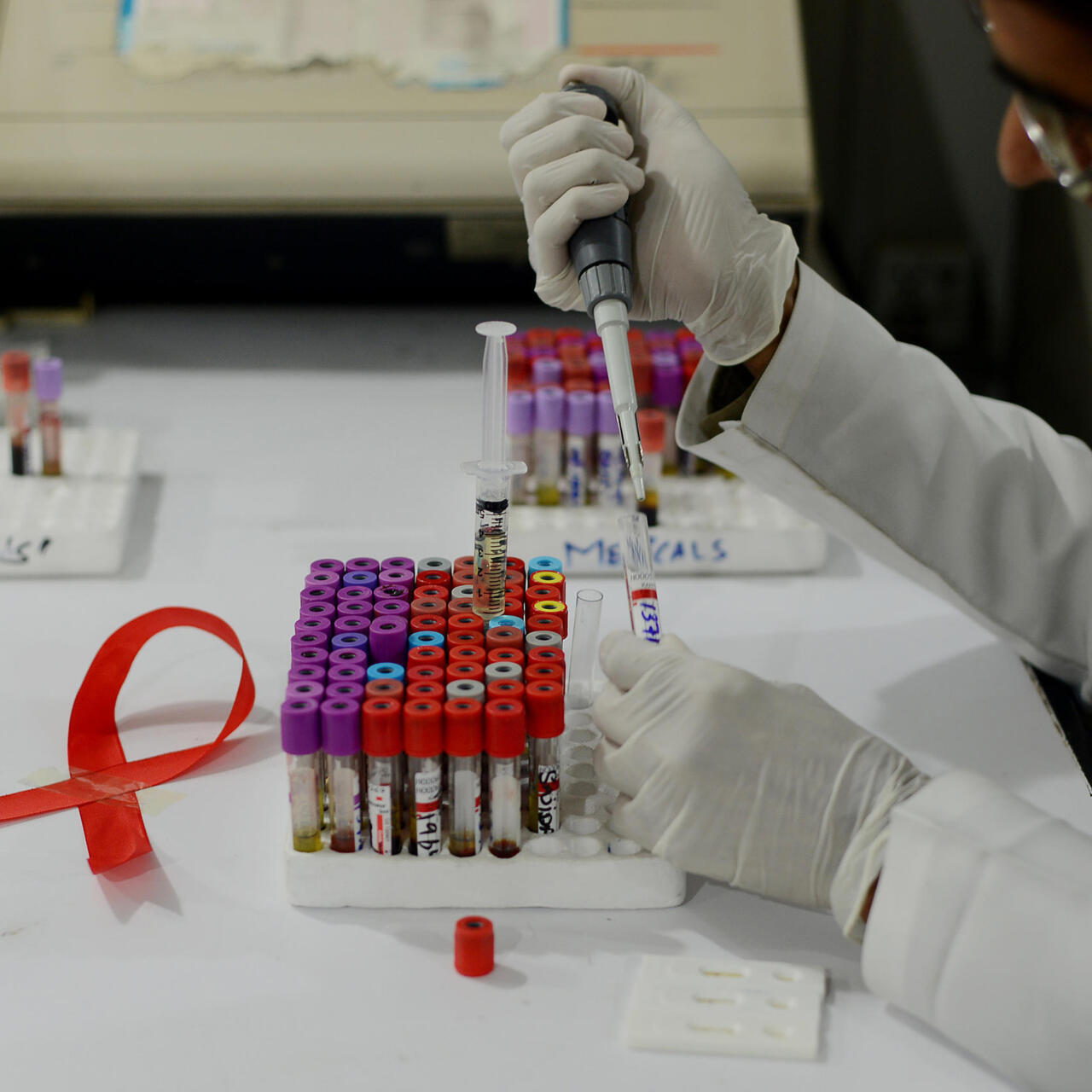 HIV & Related Diseases